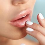 Volume enhancement for a youthful appearance